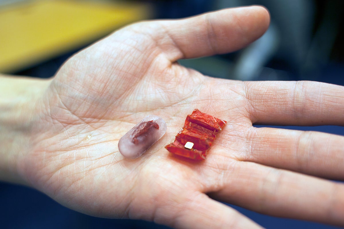 This Ingestible Robot Crawls Around Your Stomach
