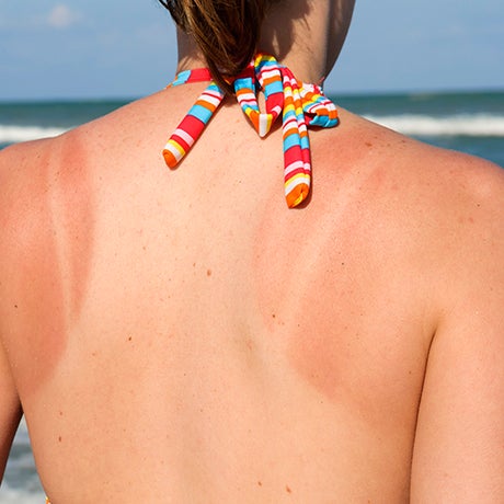 tan lines