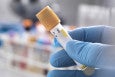 HIV test